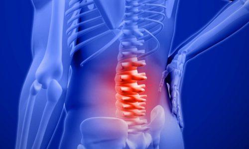 What get rid to your Lower Back Pain?